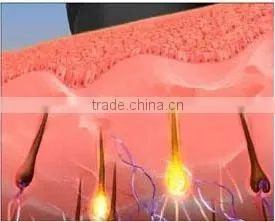 2015 factory promotion!!!!!!! Permanent opt hair removal ipl shr ssr machine