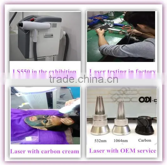 Nd Yag Laser Carbon Cream for skin deep cleansing skin whitening
