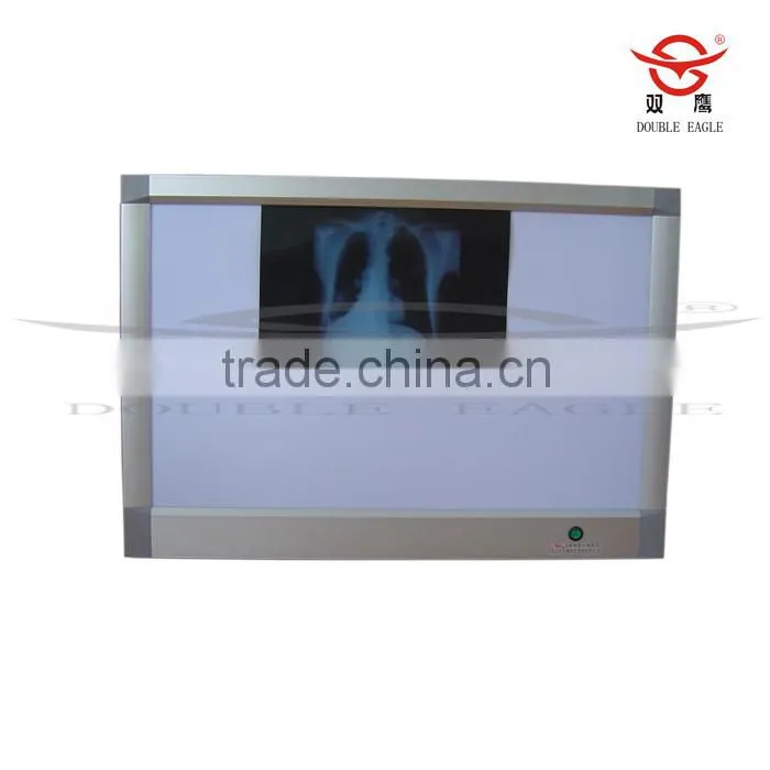 new type high quality X-RAY Film Viewer medical use