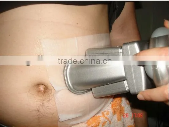 LN-164S freezing fat lipo cryo machine