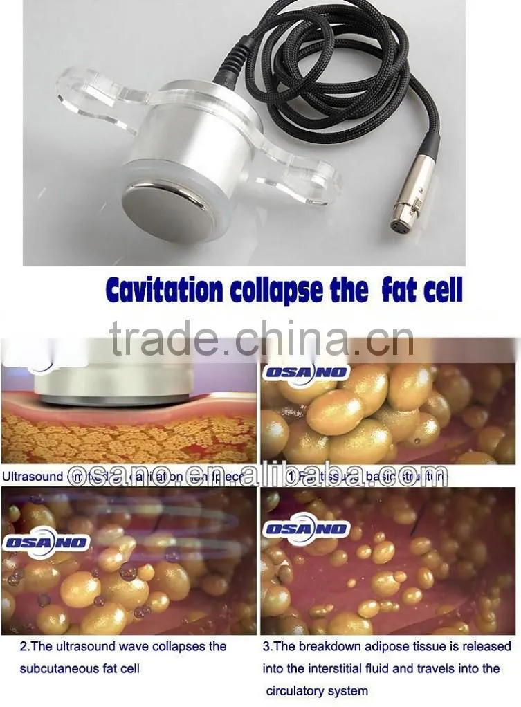 Distributor Wanted RF cavitation fat reduce instrument