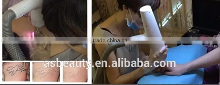 1064nm 532nm tattoo removal machine q switched nd yag laser for skin lightening