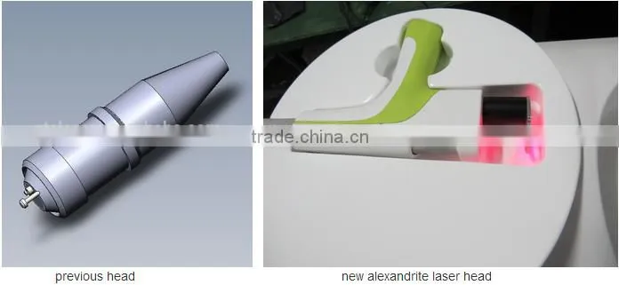 Q-Switched Ruby or Alexandrite 755 for tattoo removal