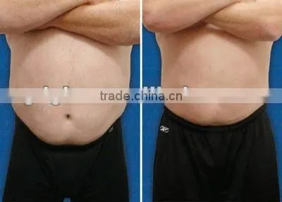 supersonic massager cavitation with lipo laser vacuum system 7 IN 1 multifunctional beauty equipment