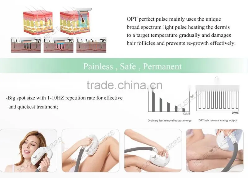Fast hair removal OPT shr laser / shr laser hair removal machine