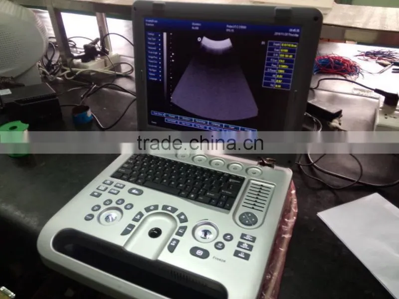 ultrasound machine ,ultrasound machine price,ultrasound scanner