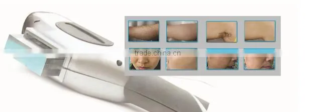 T&B 2 handles 3000W hair removal SHR OPT machine