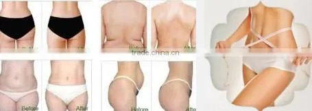 JOYFUL hot sale 6 handles fat freezing machine for double chin