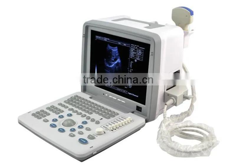 Veterinary Ultrasound Scanner ultrasound machine Vet convex rectal probe for animal use RUS-9000BV