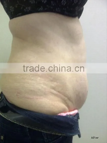 Ultra Cavi Lipo Machine-F019