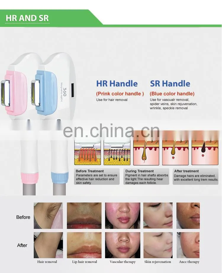 4 pcs 360 hair removal + Magneto optic +ND YAG laser +RF 4 in 1 machine for wrinkle removal tattoo removal