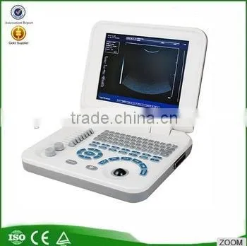 White+Bule wholesale Medical Supplier digital Ultrasound Machine for Pregnancy
