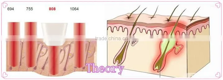 portable diode laser hair removal machine