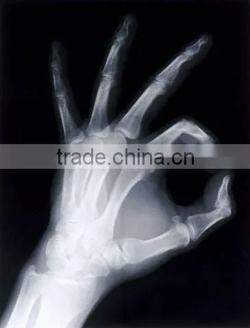 Medical film from manufacturer,x ray film,dry imaging film printed with fuji and agfa printers
