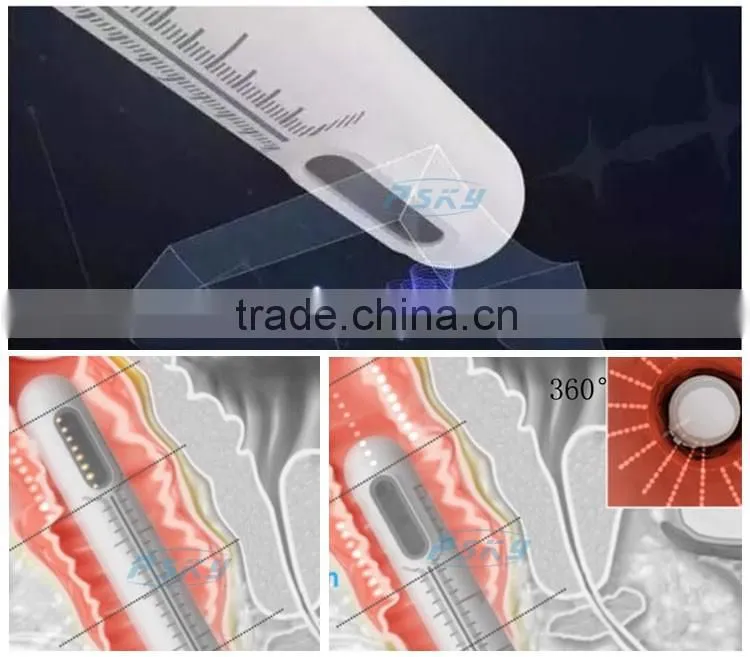 10000 shots woman painless vaginal rejuvenation HIFU machine for sale