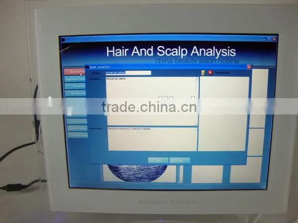 Degital Magic Mirror Hair Analysis Machine