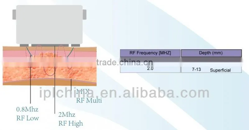 2014 Microcurrent Rf Remove Face Wrinkle Beauty Machine-IBelle 2