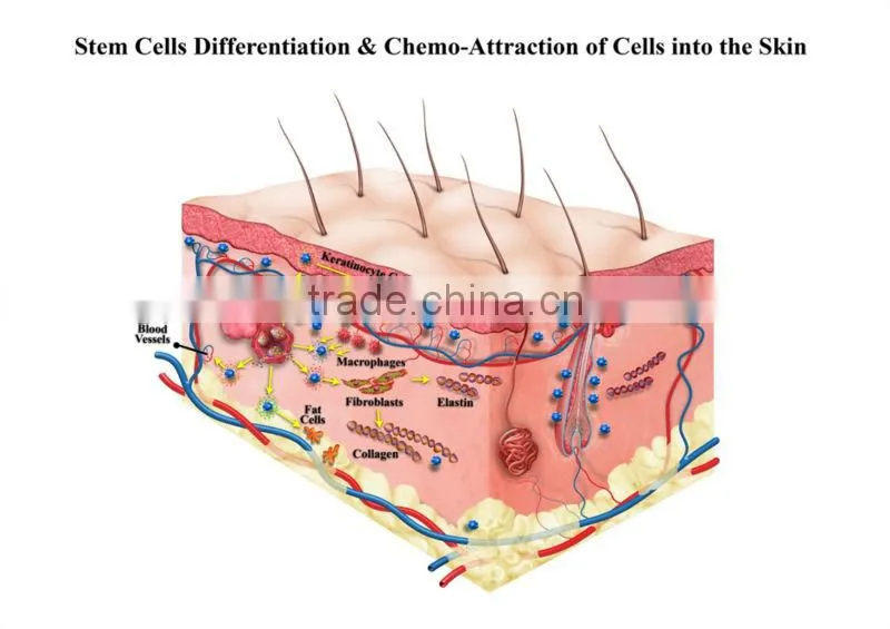 Pyrogen free ACD additive PRP tube for platelet rich plasma treatment