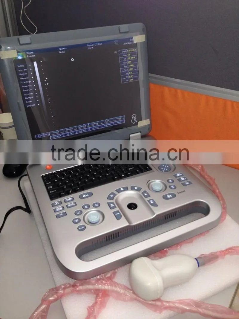 ultrasound machine ,ultrasound machine price,ultrasound scanner
