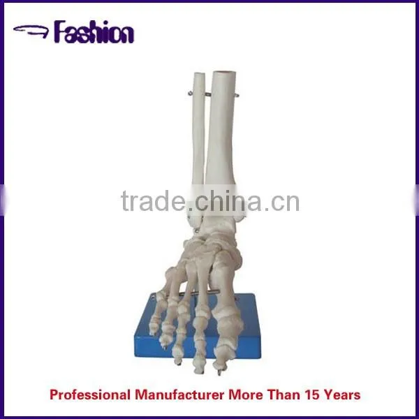 The internal structure of the human body medical device
