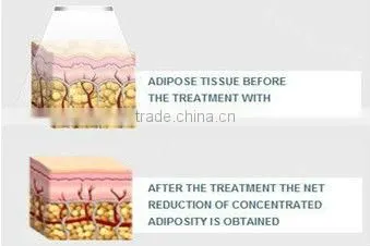 2013 Cavitation RF Ultrasonic machine S80C ISO/CE cavitation rf body sculpting