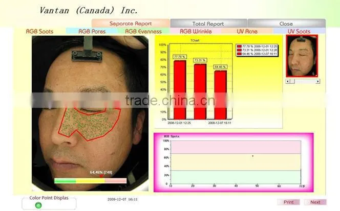 skin analyzer magnifier machine for sale