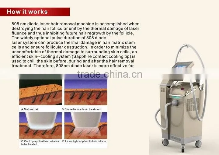 808nm wavelenth SHR rapid diode laser hair removal machine