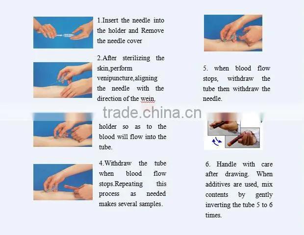 PRP tube