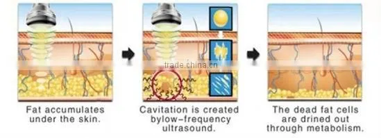 2014 Professional ultrasonic cavitation machine price