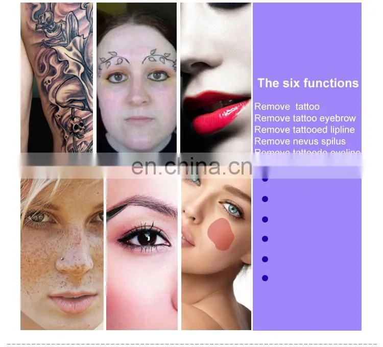 portable 2000mj laser tattoo only removal beauty machine nd yag laser