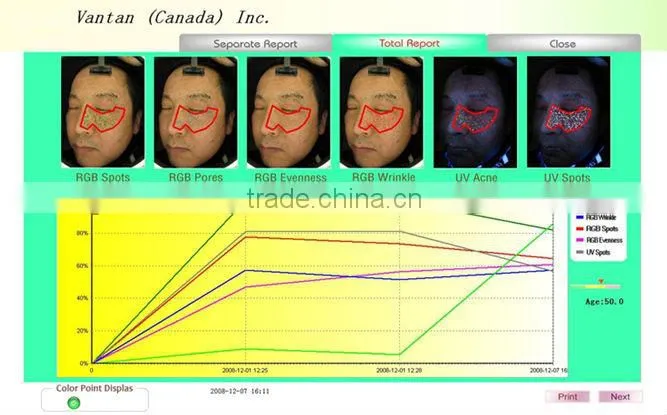 skin analyzer magnifier machine for sale