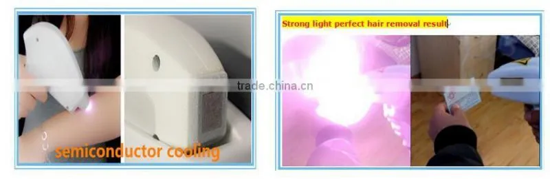 Hot selling 808nm diode laser permanent hair removal machine