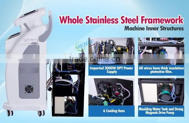 Best seller 2016 e light ipl rf system laser machine