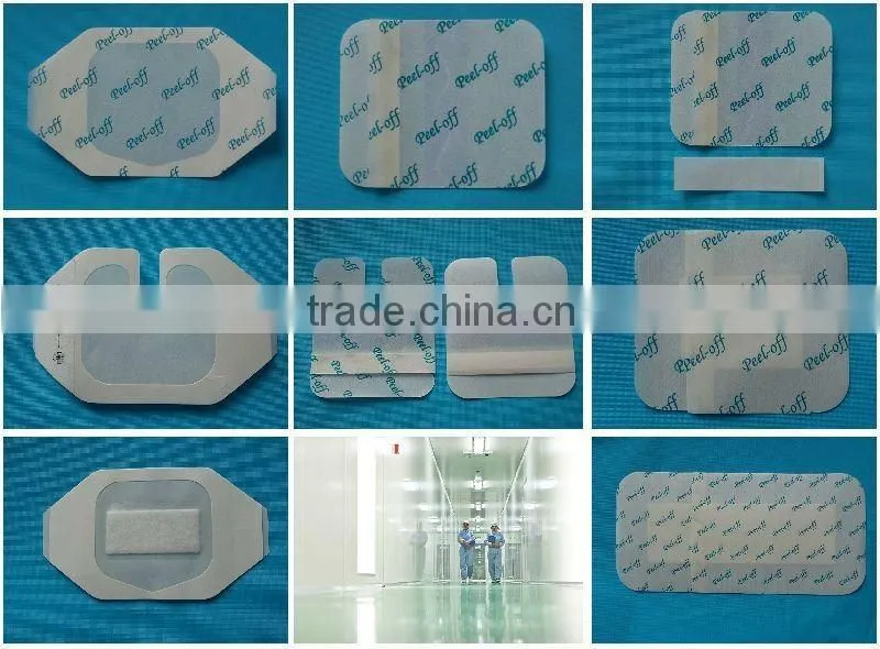 wound dressing
