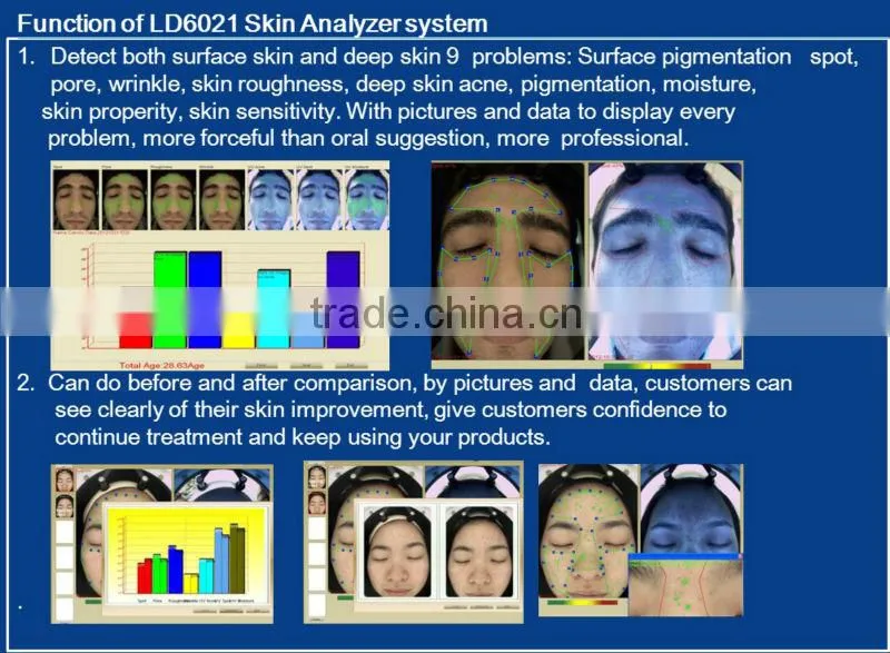 3d magic mirror system visia skin analysis machine