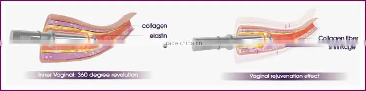 beauty machine scar removal scar treatment co2 for wholesales