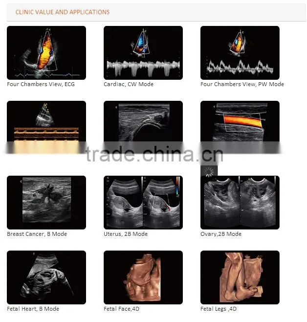 CE approved Portable Color Ultrasound Scanner with Optional 4D function( Q9)
