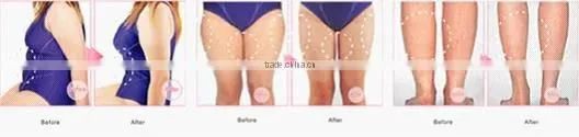 Home Use Anti cellulite Cavitation RF Slimming equipment F006