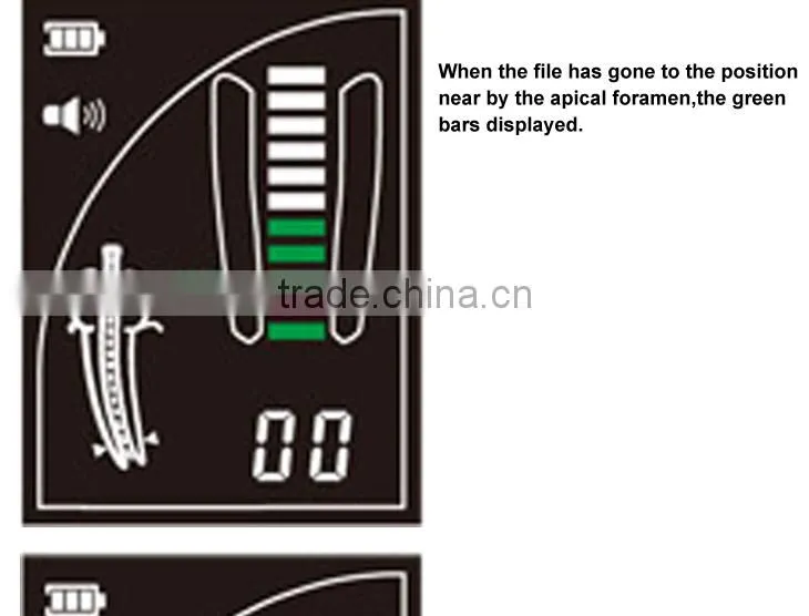 high quality 4.5 LCD root canal treatment