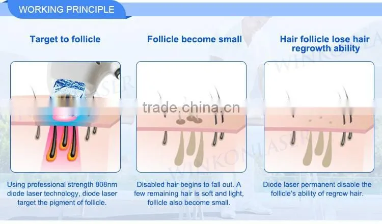 2500w 10mm*16mm (6 bar) infrared permanent diode laser 808nm hair removal machine