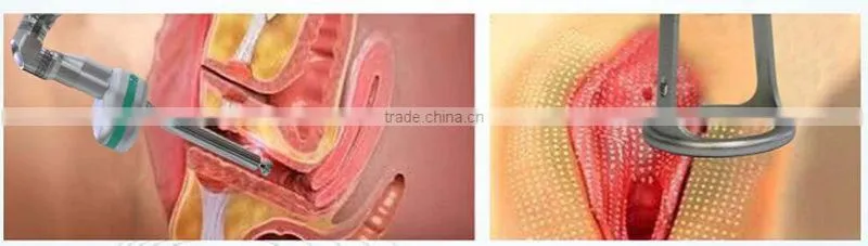 model number F7+ CO2 laser machine for sale