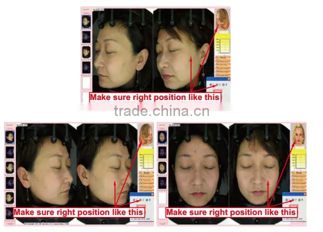 Visia skin analysis machine facial skin analyzer