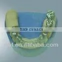 high quality laser spot soldering machine for repair dental Superwave Laser welding machine for goldsmith