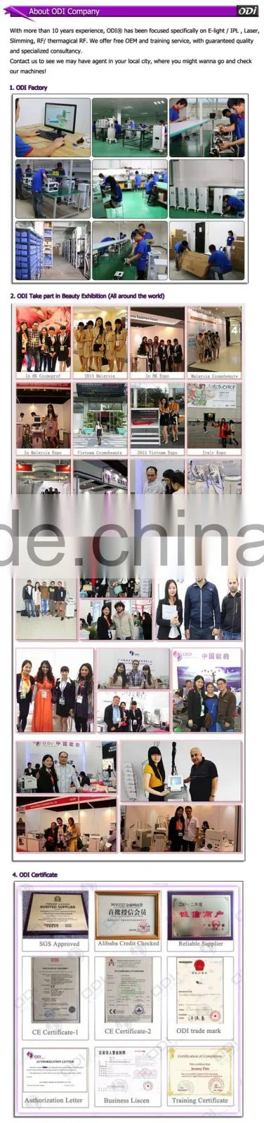 ODI machine manufacturers low laser machine price/beauty skin whitening laser machine