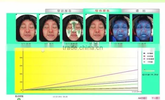 Professional 3D Camera skin diagnosis scanner skin magic mirror 3D system skin analyzer machine A10