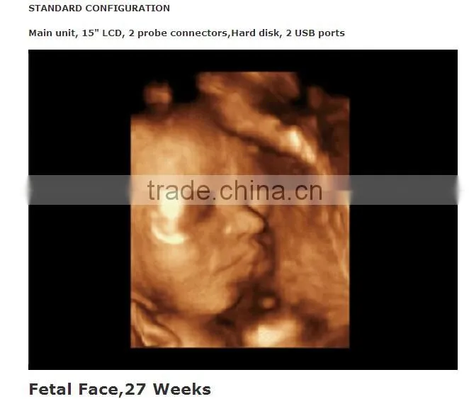 Laptop Color Doppler Ultrasound Price & portable color doppler ultrasound machine