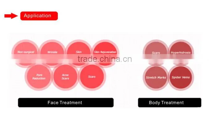 Micro-Needle RF scar and wrinkle removal equipment -MNF100
