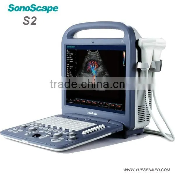 Color ultrasound scanner sonoscape veterinary ultrasound