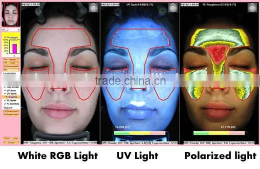Portable smart skin reveal facial skin analyser machine
