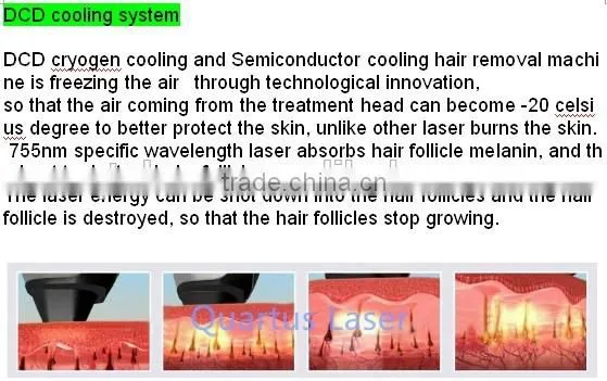 Best Buys Alexandrite laser painless hair removal machine for beauty clinic